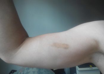 © Rechtsanwalt Mag. Andreas Strobl Strafverteidiger Anwalt Verteidiger in Strafsachen Körperverletzung